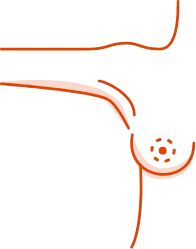 GC Aesthetics® medical illustration