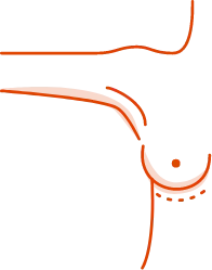 GC Aesthetics® medical illustration